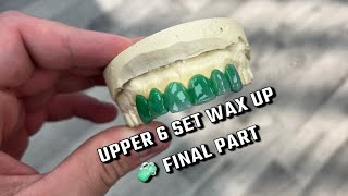 Upper 6 Set Grillz Wax Up Final Part [upl. by Nojed]