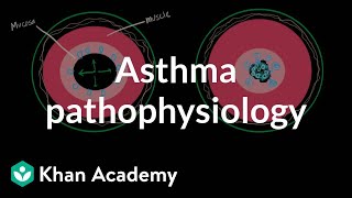 Asthma pathophysiology  Respiratory system diseases  NCLEXRN  Khan Academy [upl. by Nyrraf]