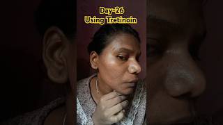 Day26 Using Tretinoin 0025 cream viralvideo tretinoin shorts skincare youtubeshorts [upl. by Catherina]