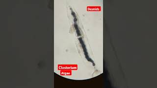 Closterium algae view under microsporeDesmidsMsc Botanypractical mscbotany botany shorts [upl. by Herm]