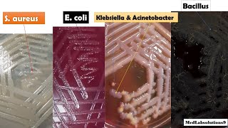 Most Common Bacterial Colony Morphology E coliKlebsiellaPseudomonasProteusStaphylococcusBaci [upl. by Barra572]