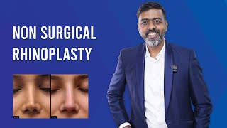 NonSurgical Rhinoplasty  Treatment Results Benefits amp Cost By Dr Sunil Richardson [upl. by Ambrosine]