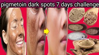 dark spot remover cream malayalampigmetoin dark spots remove [upl. by Campball528]