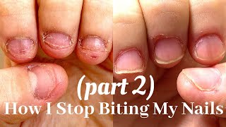 How I Stop Biting My Nails in 2020 nail journey part 2 [upl. by Winters]