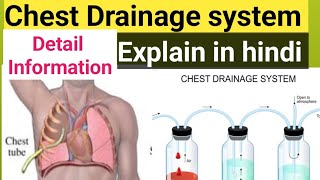 chest Drainage system explain in hindi water seal drainage system youtubeviralvideoyoutuber [upl. by Groome]