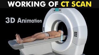 Working Of CT Scan 3D Animation UrduHindi [upl. by Wald]