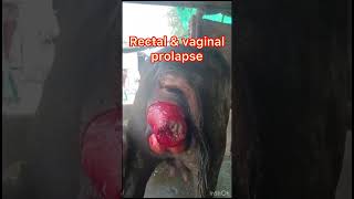 Prolapse l uterine prolapse l rectal prolapse l vaginal prolapse l dr Umar khan [upl. by Eikcor]