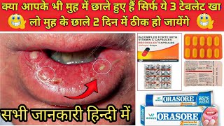 सिर्फ ये टेबलेट खा लो मुह के छाले 1 दिन मेें ठीक हो जायेंगे  Stomatitis Treatment in hindi  Ulcer [upl. by Hamitaf978]