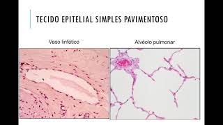 3 Tecido epitelial de revestimento classificacÌ§aÌƒo meÌdio [upl. by Tychon]