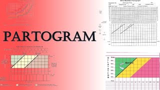 Partogram  Labour Monitoring and Assessment of Fetal WellBeing  TOACS amp OSCE Station [upl. by Servais]