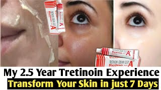 Tretinoin Creamafter using 1 Year full details002500501Pm Skincare with retinAin 2022 [upl. by Nnylidnarb536]