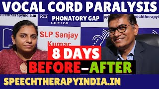 BeforeAfter  Vocal Cord Paralysis Treatment  Phonatory Gap  Within 8 Days  By slpsanjaykumar [upl. by Crelin976]