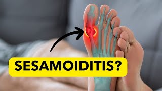 SesamoiditisHome Remedies What is It Pain at the base of Big Toe [upl. by Aldercy]