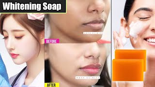 Skin Whitening Soap with Salicylic Acid  Benefits Uses amp Side Effects [upl. by Eedoj]