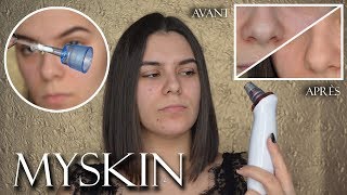 JE TESTE LASPIRATEUR À POINTS NOIRS  MYSKIN [upl. by Kerat]