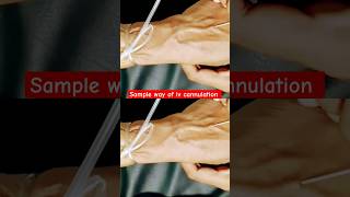 Blood collectionBlood collection techniqueBlood collection iv cannulation method youtubeshorts [upl. by Htnicayh]