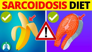 Sarcoidosis Diet  ONLY Eat These Foods and Which Ones to AVOID [upl. by Felecia]