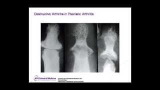 NYU Advanced Rheumatology Board Review Course Preview [upl. by Fafa]