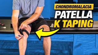 Relieve Knee Pain FAST Chondromalacia Patella K Taping [upl. by Epuladaugairam981]