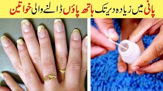 Get Rid of Toenails Fungus Natural Treatment amp Cure Simple Home Remedies Urdu Hindi [upl. by Giesser775]