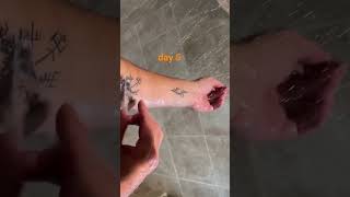 Tattoo healing day 5 saniderm removal [upl. by Yecniuq]