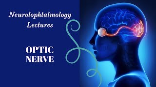 NEUROOPHTHALMOLOGY lecture 10 OPTIC ATROPHY [upl. by Angelica]