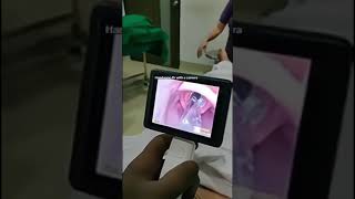 Video laryngoscope intubation [upl. by Prentiss]