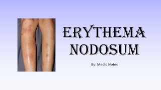 Erythema nodosum  causes pathophysiology sign value [upl. by Moersch]