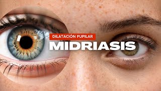 Iridología Midriasis [upl. by Aerdnac797]