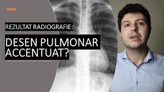 Ce înseamnă desen pulmonar accentuat pe radiografie [upl. by Parnell]