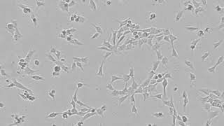 iPSC derived neural crest cell proliferation timelapse  Using CytoSMART Lux2 livecell imager [upl. by Lanae]