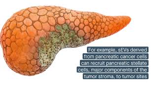 Small extracellular vesicles Metastasis mediators and potential therapeutic tools [upl. by Basile]