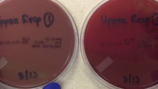 Plate Reading  Upper Respiratory I [upl. by Alat]