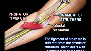 Pronator Teres Syndrome  Everything You Need To Know  Dr Nabil Ebraheim [upl. by Crosby]