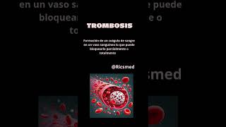 Triada de Virchow triadadewirchow viral viralvideos video medicina doctor quiz fyp parati [upl. by Aicemaj]