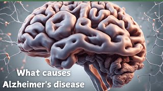 quotUnderstanding Alzheimer’s Causes Risks and Hope for a Cure [upl. by Eisen364]