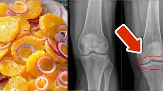 8 einfache Wege um Knie Knorpel und Bänder zu stärken🤯Super einfach💥 [upl. by Arratal784]