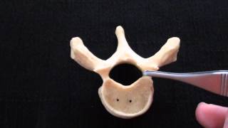 Typical Vertebra  Spinal column  Anatomy [upl. by Omrellig]