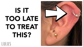 LULUSANSWERS  When Is It Too LATE to Treat Piercing Bumps [upl. by Cara]