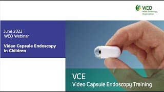 Video Capsule Endoscopy in Children [upl. by Ingmar77]