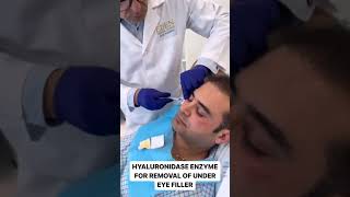 Hyaluronidase Enzyme for UnderEye Filler Removal  EDEN AESTHETICS Clinic Dubai [upl. by Darcia942]