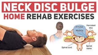 Neck Disc BulgeHerniation Rehab Exercises [upl. by Nahtnanhoj]