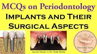 Basic Aspects of Dental Implants  MCQs in Periodontology  Periodontics Revisited [upl. by Yseult618]