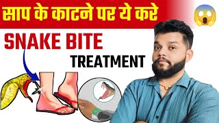 Snakebite Treatment Hindi  Snakebite Primary Treatment [upl. by Haney]