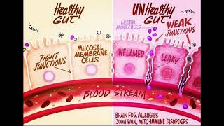 Leaky gut diet plan [upl. by Chicoine]