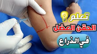 تعلم اعطاء الحقن العضل في الذراع بدلا من المؤخرهLearn to give the im injection in the arm [upl. by Savinirs]