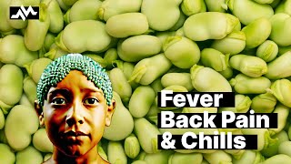 Fever Back Pain and Chills  Case Report [upl. by Oibesue]