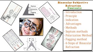 Binocular Subjective Refraction  Full Tutorial [upl. by Limay]