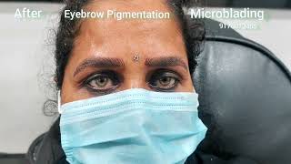 Microblading  Eyebrow  Pigmentation  Tattoo  Removal  Chennai  Tamilnadu  India  JackTattoos [upl. by Ormand999]