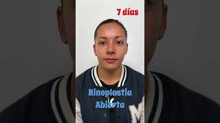 rinoplastia lipoescultura aumentomamas aumentogluteo liftingfacial blefaroplastia otoplastia [upl. by Tabby]